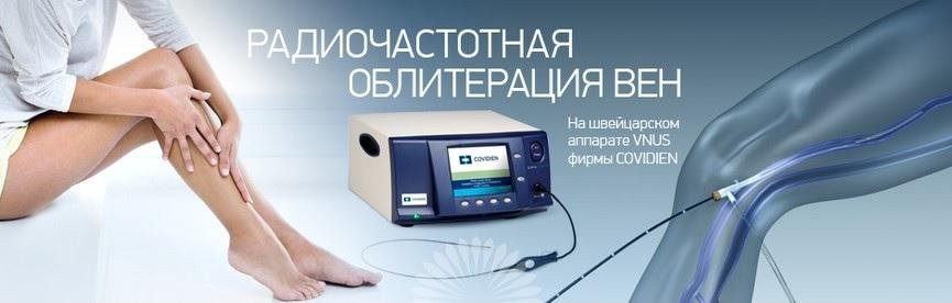 Радиочастотная облитерация вен нижних конечностей (РЧО, Closure FAST) в Москве