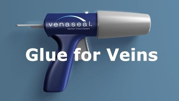 Лечение варикоза биоклеем Venaseal. Клеевая облитерация вен.